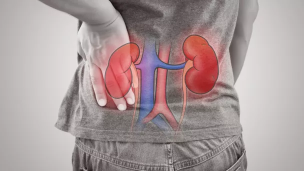 calculs rénaux ou urinaires